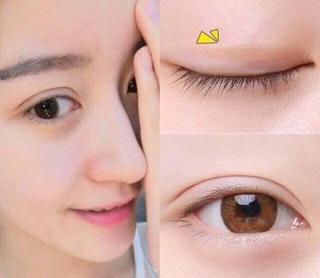 Kích mí lưới 20 miếng dán kích mí lưới Trung Quốc