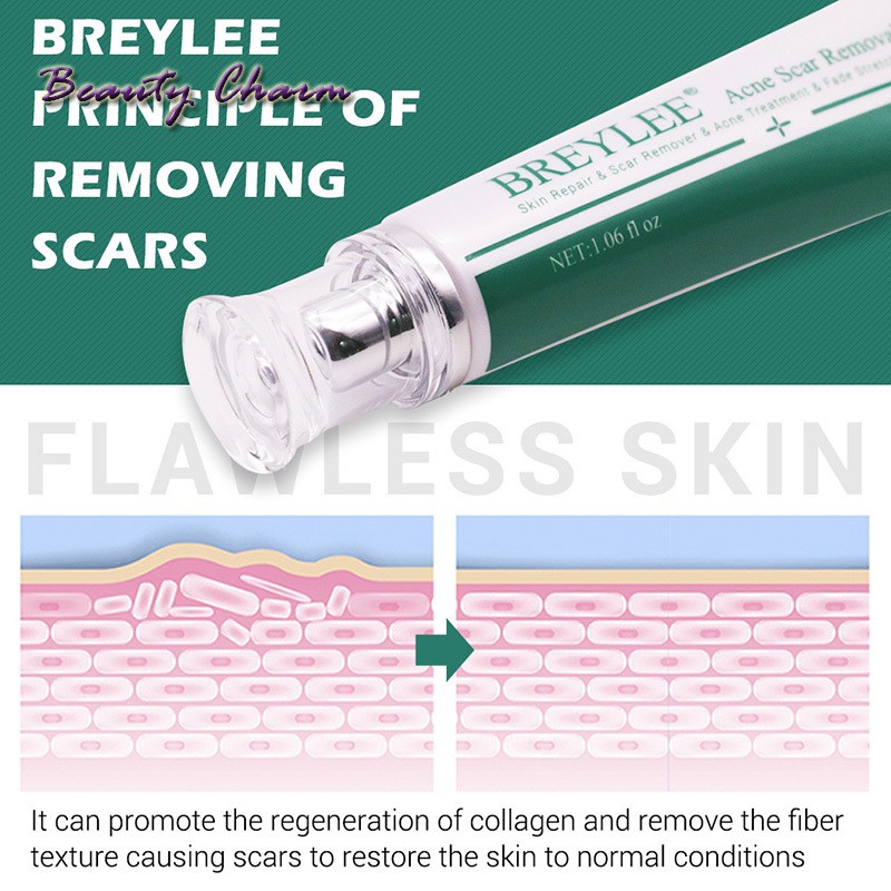 [Hàng mới về] Kem Hỗ Trợ Giảm sẹo 30ml chuyên dụng | BigBuy360 - bigbuy360.vn