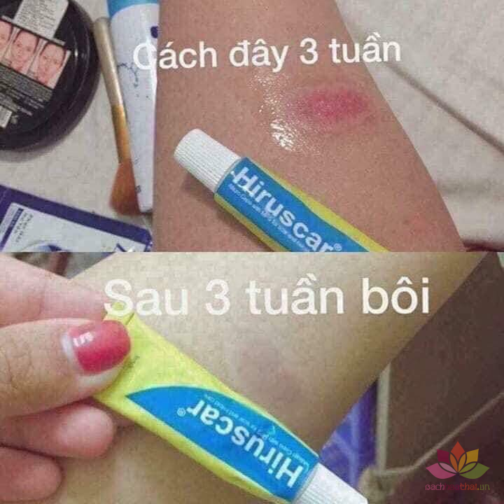 Gel làm mờ şẹo Hirucas -7g (Thailand)