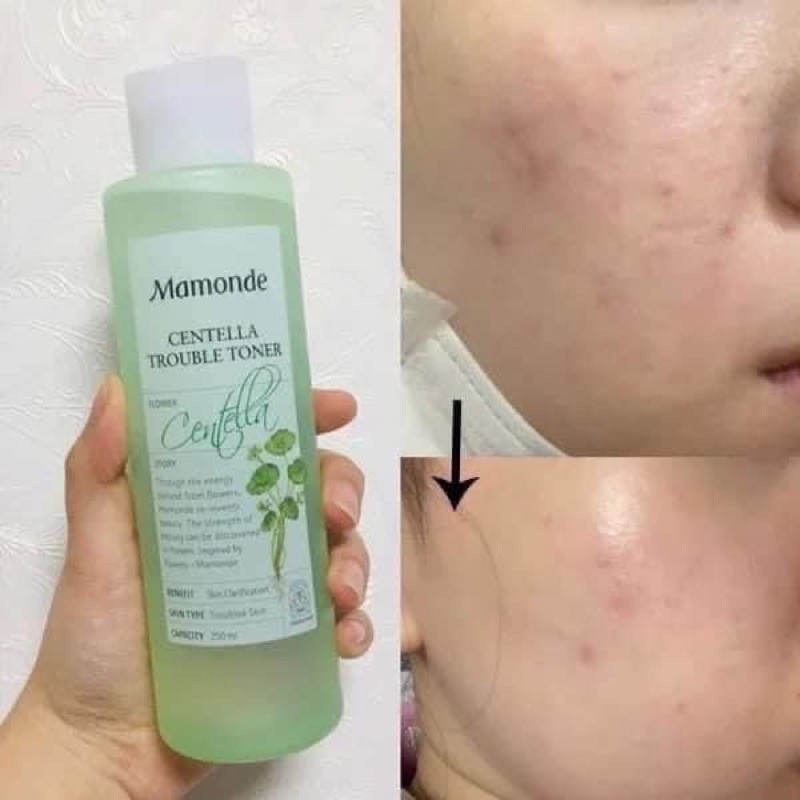 Nước hoa hồng từ rau má Mamonde Centella Trouble Toner | BigBuy360 - bigbuy360.vn