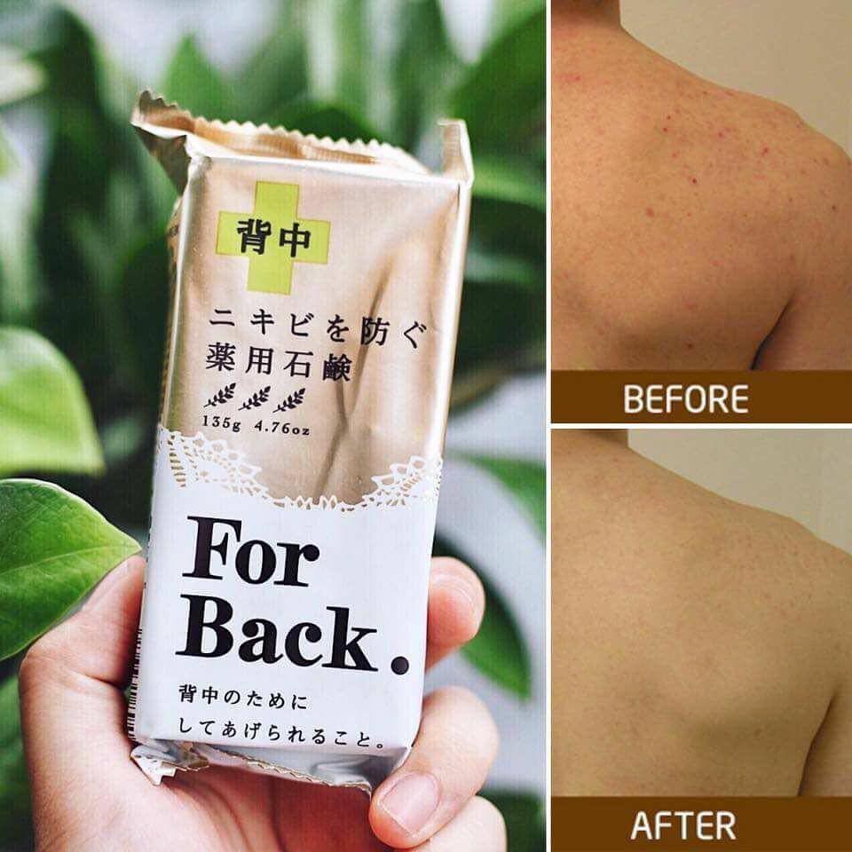 Combo Nước hoa hồng diếp cá DOKUDAMI NATURAL SKIN LOTION và Xà Phòng Giảm Mụn Lưng For Back