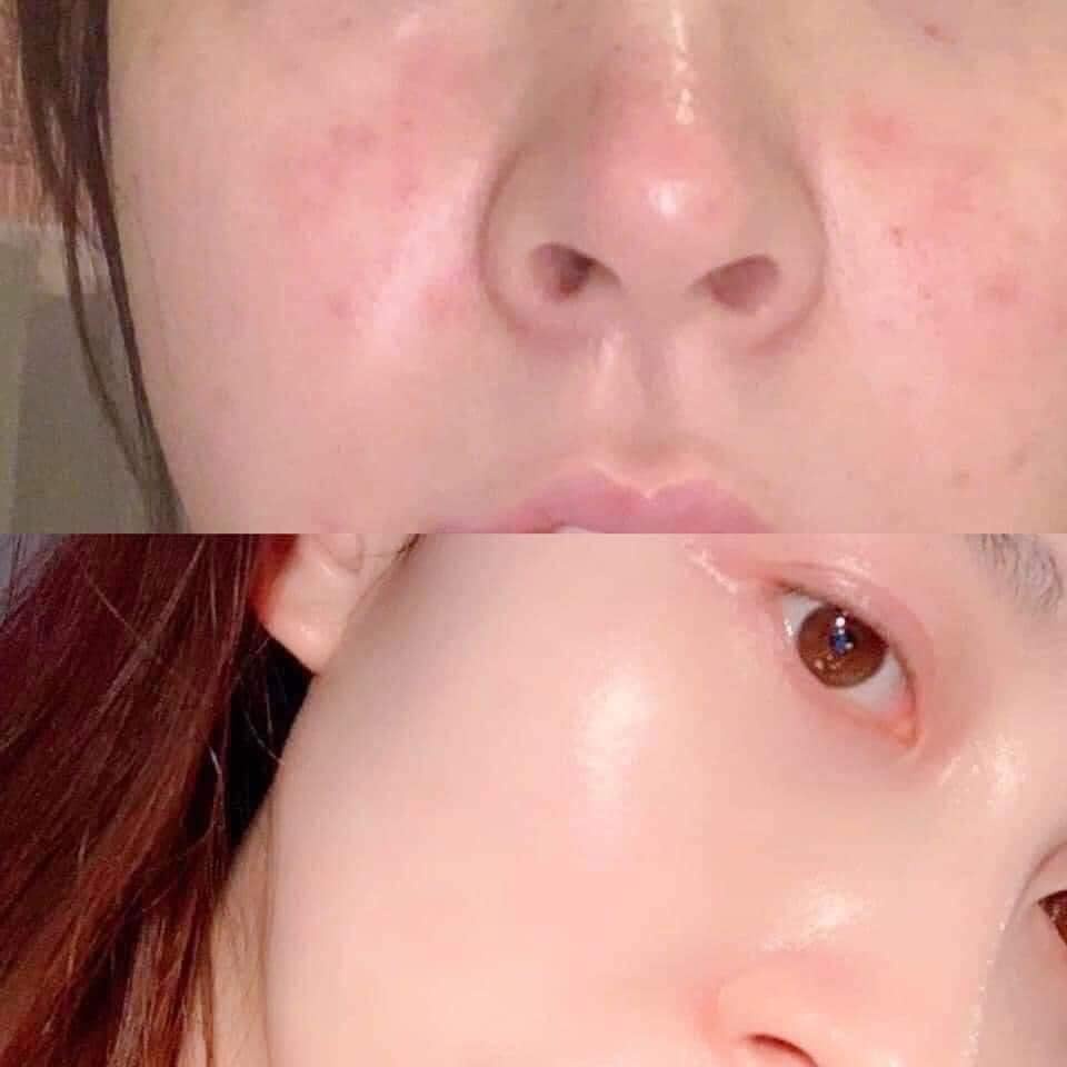 Hộp Collagen Uống Lựu Đỏ Bio Cell Bổ Sung Lợi Khuẩn