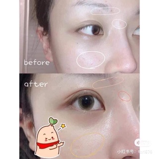 Kem dưỡng phục hồi Avene Cicalfate