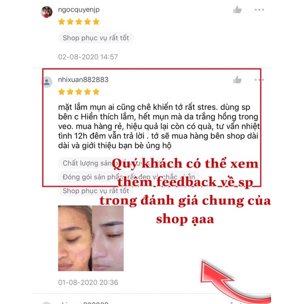 Thay Da Sinh Học Peel TCA Zenus