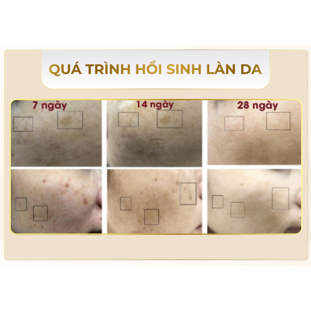 ❤️ ❤️ Dưỡng da Hoshi Nhật Bản - Hạn chế quá trình Oxy hóa, giảm sạm nám, tàn nhang, giúp da trắng mịn