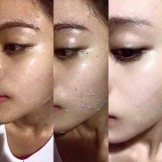 Tẩy tế bào chết M'white