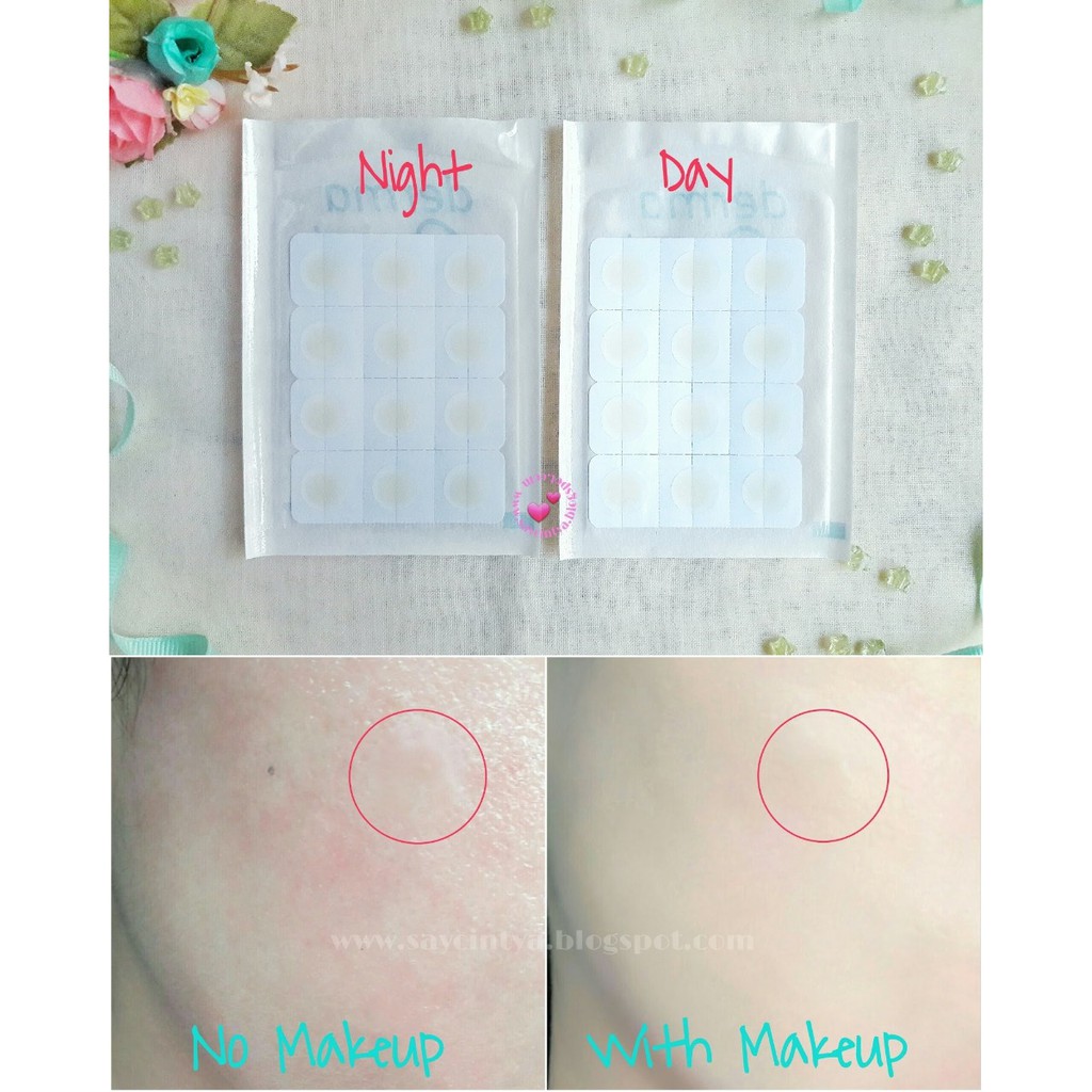 Miếng dán mụn Acne Patch Derma Angel Hasaki Sản Phẩm Chính Hãng