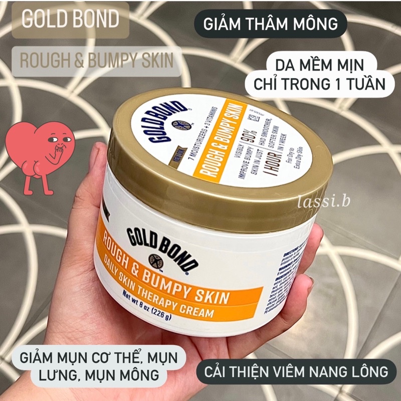Kem dưỡng Gold Bond Rough&Bumpy Skin dành cho da sần sùi, da gà, viêm nang lông