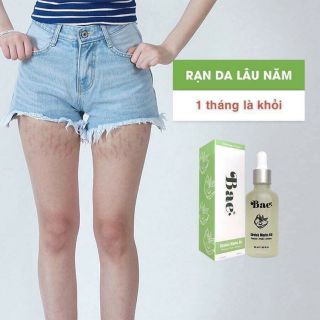 Kem trị dạn da Bae