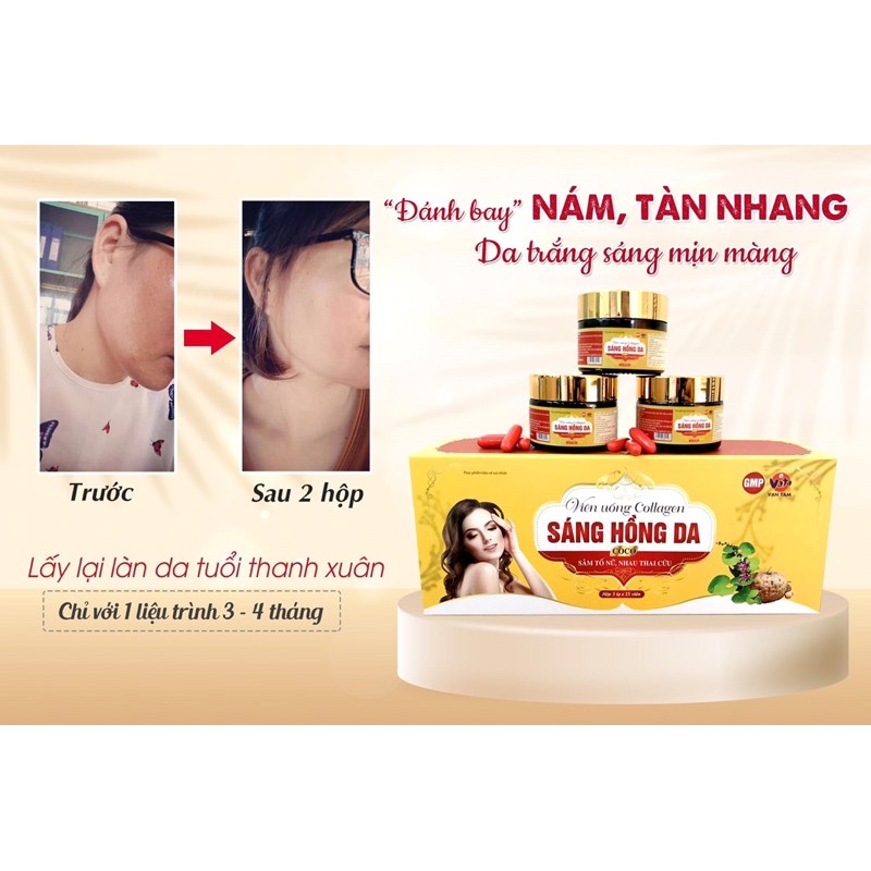 ✅(CHÍNH HÃNG) Viên uống Collagen Sáng Hồng Da CoCo, sâm tố nữ, Nhau thai cừu. làm sáng da, giảm nám, tàn nhan, trắng da