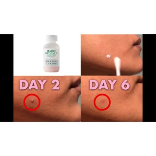 MARIO BADESCU Lọ Chấm Mụn Drying Lotion