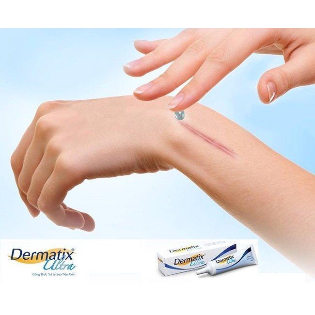 【Từ tp Hồ Chí Minh gửi hàng】kem xóa sẹo Dermatix Ultra 15g, Làm mờ sẹo chuyên sâu, an toàn, tiện lợi, dễ dàng sử dụng làm phẳng, mềm sẹo lồi, sẹo thâm, sẹo rỗ, sẹo phì đại, thấm nhanh, không cần massage, không nhờn dính - Bảo vệ khỏi tia UVA và UVB