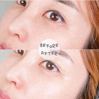 Kem mắt AHC Ultimate real eye cream
