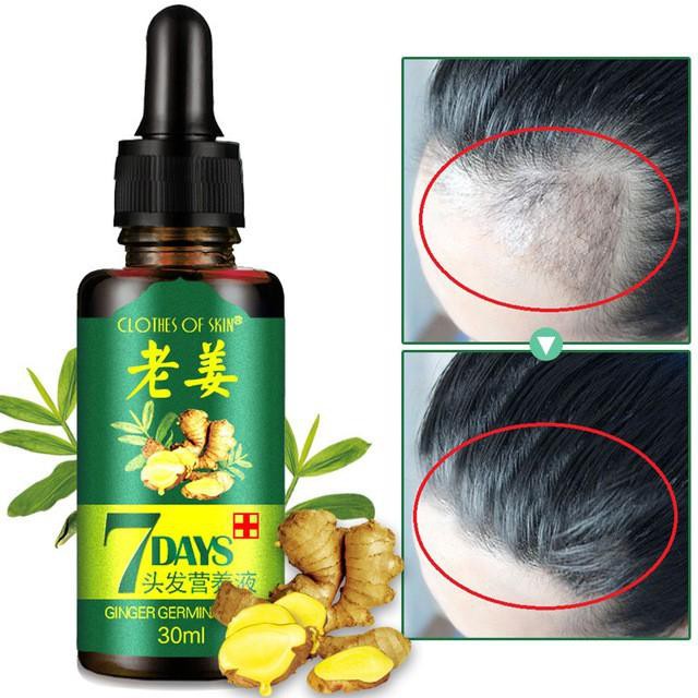 Serum mọc tóc, kích thích phát triển tóc, dưỡng tóc 7 ngày