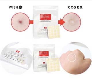 Miếng dán mụn Cosrx