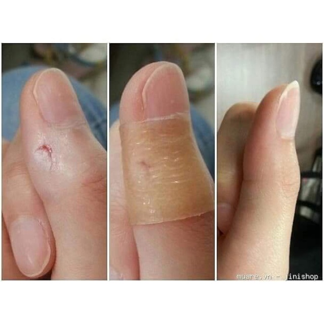 👉 Miếng dán mụn Duoderm Extrathin USA nk chính hãng | BigBuy360 - bigbuy360.vn