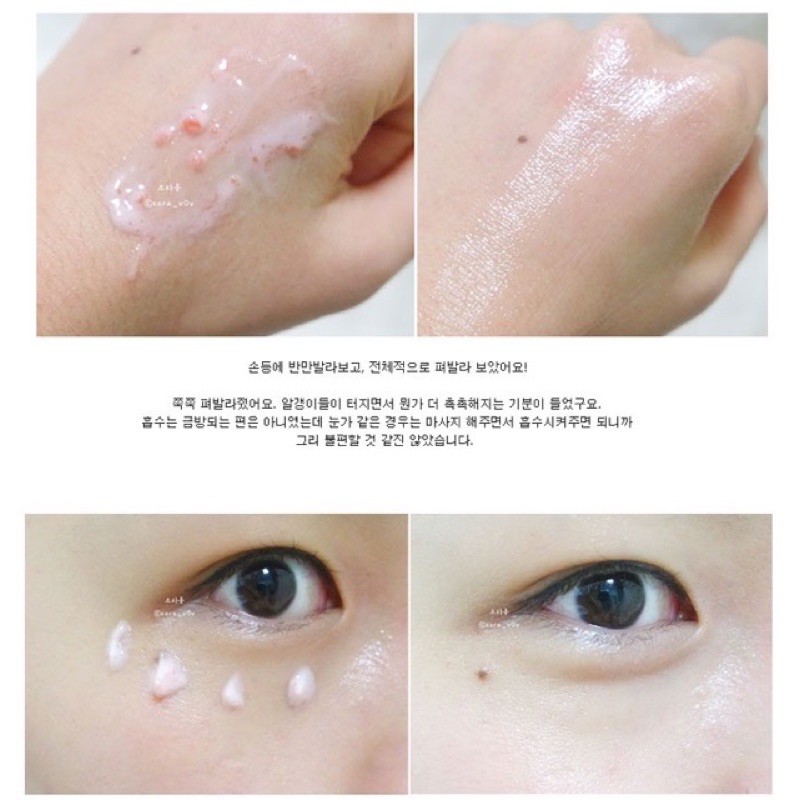 Kem DNA trứng cá hồi BRTC SALMON FILLEX VOLUME INJECTION | BigBuy360 - bigbuy360.vn