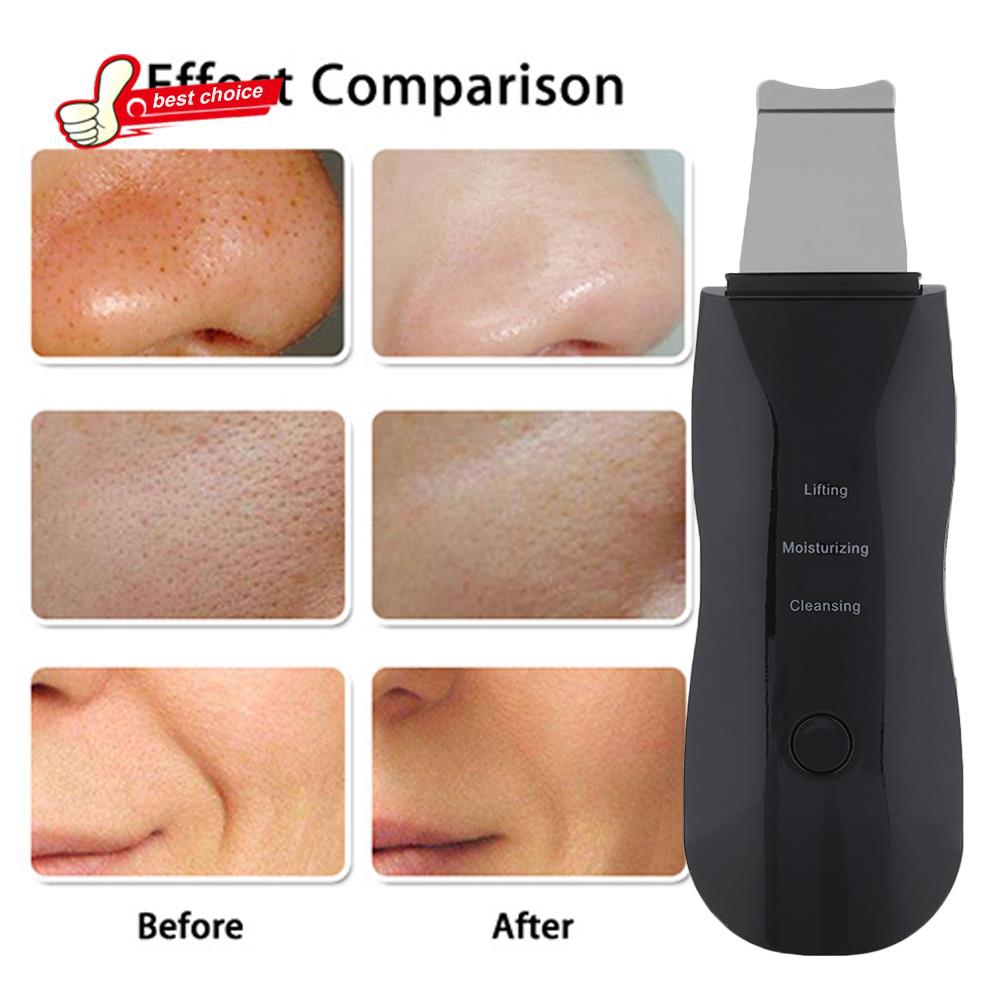 Máy cà da hút mụn làm đẹp hiệu quả màu đen | BigBuy360 - bigbuy360.vn