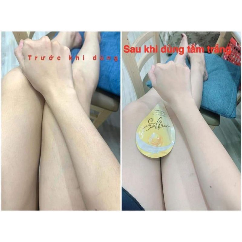 Combo Kem Body Collagen X3 - Ủ Trắng Saffron Đông Anh