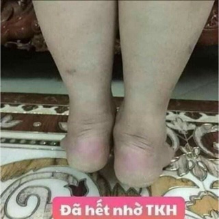 THẢO MỘC BÔI DA ĐEN TKH
