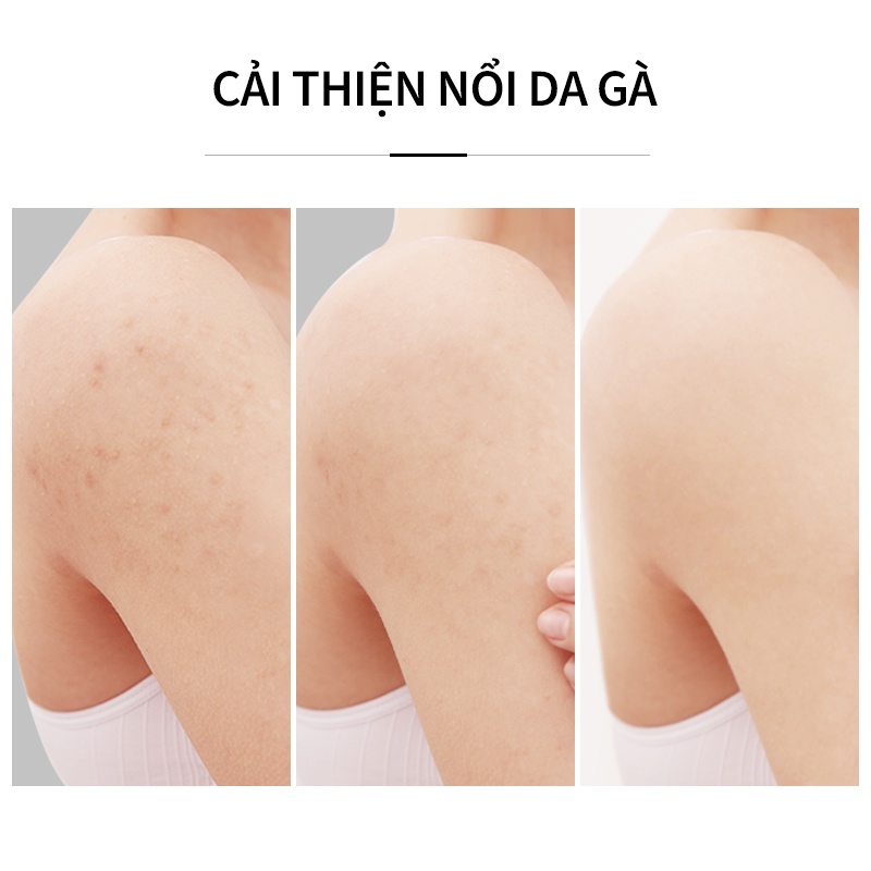 Lotion Honey&amp;Beauty Acid 300g Dưỡng Ẩm Cho Cơ Thể