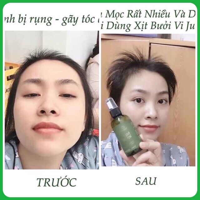 Xịt bưởi Vijujly ngăn rụng , mọc tóc ( chính hãng)