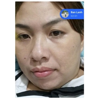 SERUM THẢO DƯỢC NHÂN SÂM SẠCH MỤN MAY NEW 50ML
