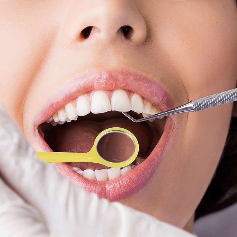 Gương soi răng, gương nha khoa, niềng răng, chăm sóc răng niềng