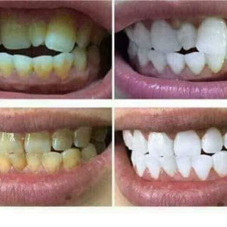 BỘT TRẮNG RĂNG THAN HOẠT TÍNH SIÊU CAO CẤP
