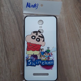 Ốp xiaomi mi note 3 in hình