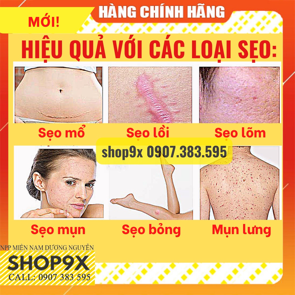 Kem Sẹo Peimei - Giảm Sẹo Và Rạn Da Hiệu Quả Sau 1 Tuần 30gr