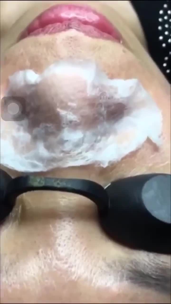 Ủ Mụn Youngerc - Đẩy tan mọi loại mụn - Siêu phẩm ủ mụn | BigBuy360 - bigbuy360.vn