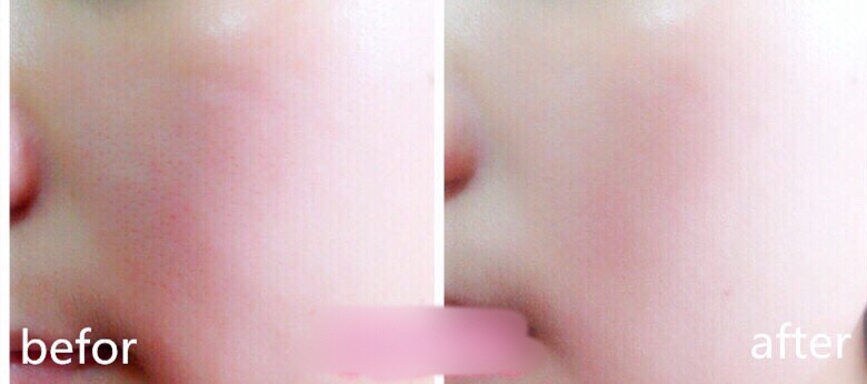 Viên Kén Tằm Căng Bóng Da | Thế Giới Skin Care