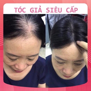 [TÓC GIẢ] [HÌNH THẬT] TÓC CHE HÓI ĐỈNH ĐẦU 2 MÁI NHIỀU ĐỘ DÀI