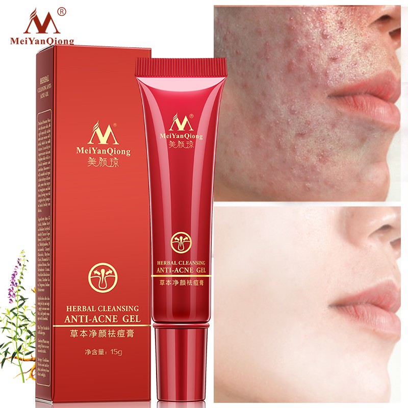 Kem Chăm Sóc Da Mặt MeiYanQiong 15g Làm Sáng Da Cải Thiện Độ Thô Ráp Và Xỉn Màu | BigBuy360 - bigbuy360.vn