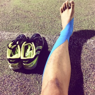 Băng keo dán cơ bắp-kinesiology tape