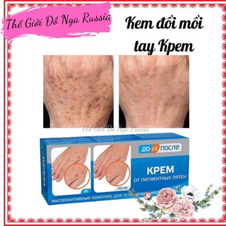 Kem đồi mồi tay, Giảm đồi mồi tay chân