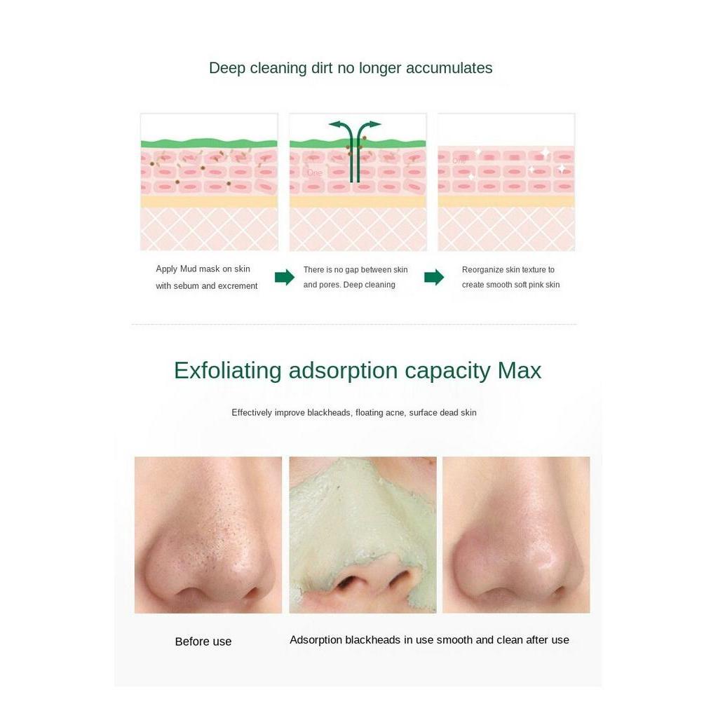 Mặt nạ bùn làm sạch sâu kiểm soát dầu hiệu quả cho da