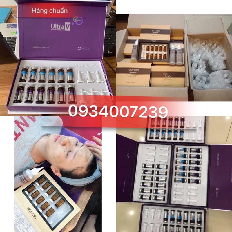 VI KIM TẢO BIỂN UTRA V