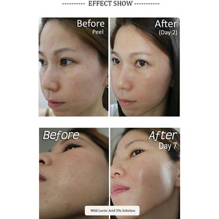 Serum The Ordinary AHA 30% + BHA 2% Peeling solution