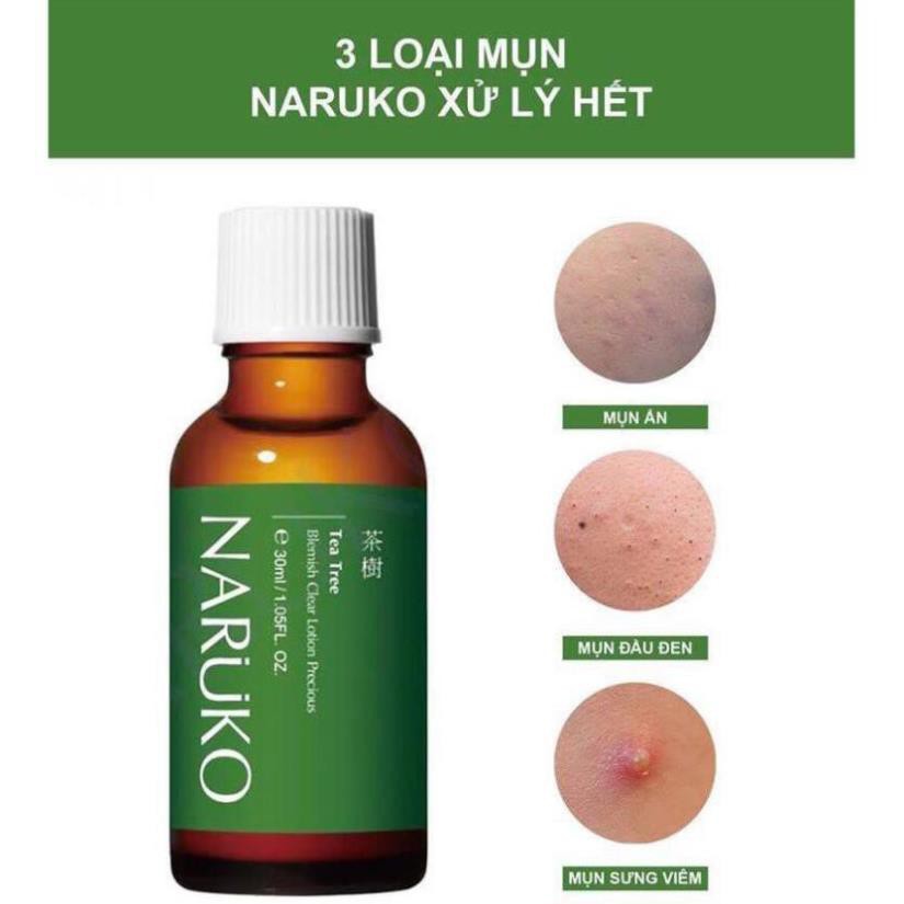 NARUKO - Lotion Tràm Trà Đậm Đặc Giảm Mụn Mảng, Mụn Đầu Đen 30ml – Tea Tree Blemish Clear Lotion Precious 30ml