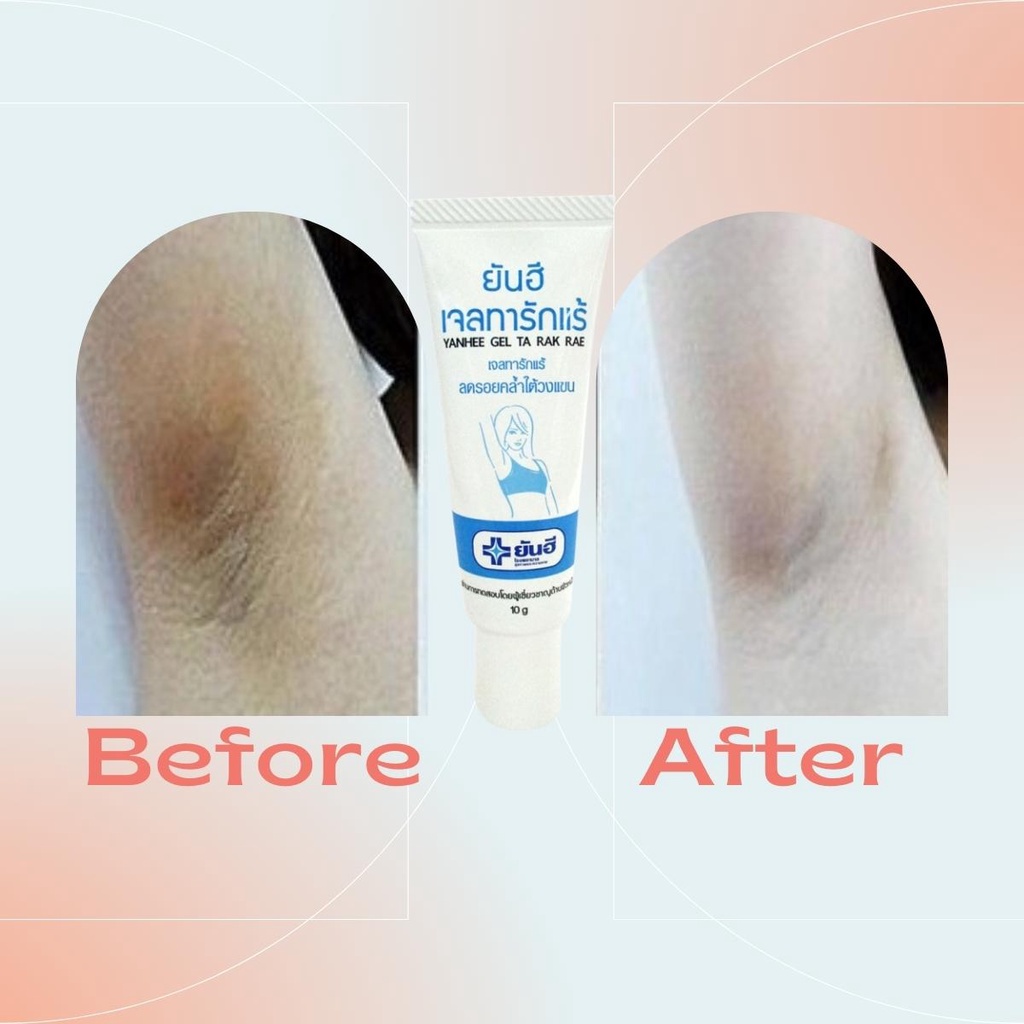 Gel Trị Thâm Nách Yanhee Gel Ta Rak Rae