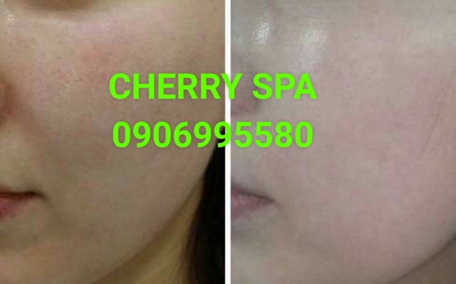 SERUM OLY HT DƯỠNG TRẮnG DA CHỐNG NẮNG SE KHÍT LỖ CHÂN LÔNG 20ml