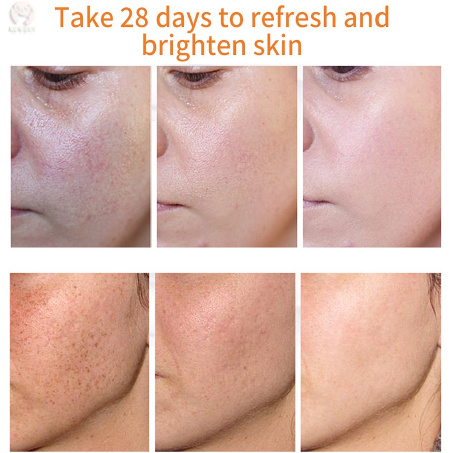 Kem Hỗ trợ giảm tàn nhang Làm Trắng Da Loại Bỏ Nám Tàn Nhang 50g TTLIFE