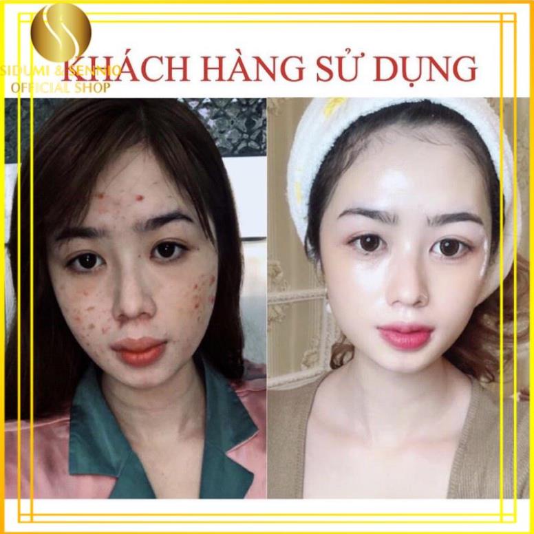 Serum Giảm Mụn - Chấm Mụn - Làm trắng, chống nếp nhăn,