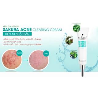 Sakura Acne Clearing Cream - Kem giảm mụn chính hãng