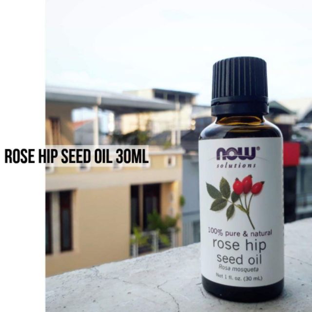 Dầu Hạt Tầm Xuân - Now Foods Rosehip Seed Oil - Dầu dưỡng cho da dầu mụn & hỗn hợp - 100% Pure Rose Hip Oil & Organic | BigBuy360 - bigbuy360.vn