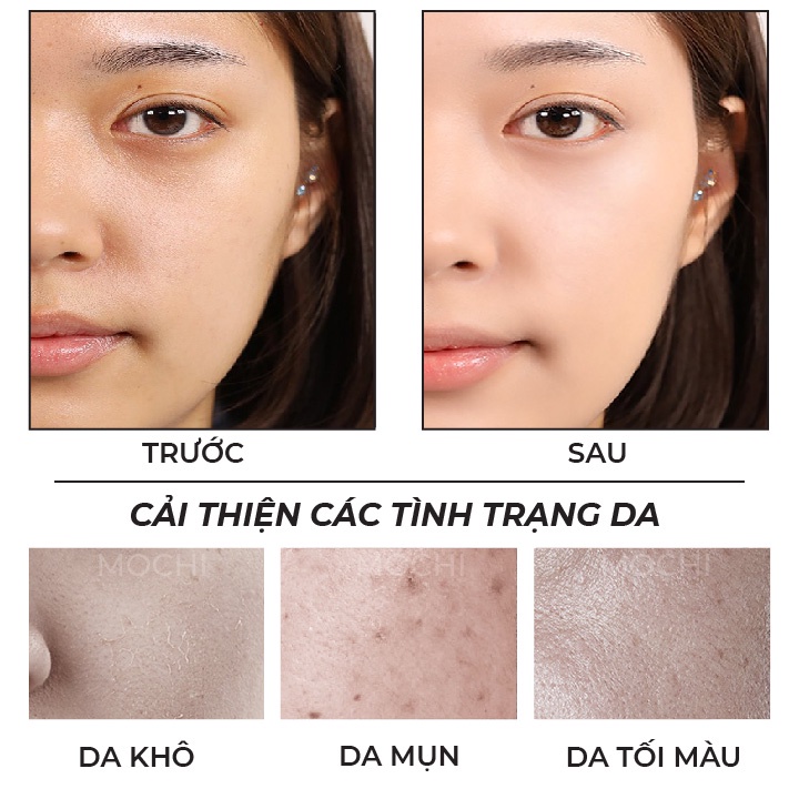 Mặt Nạ Lá Trà Thực Vật Giảm Mụn Kiềm Dầu l Dưỡng Trắng Da l Cấp Ẩm Mask Giấy Đắp Mặt Images Nội Địa Trung MOCHI SHOP