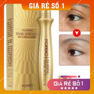 Lăn mắt ❤️𝑭𝒓𝒆𝒆𝒔𝒉𝒊𝒑❤️ cây lăn mắt ốc sên giảm quầng thâm bọng mắt rorec