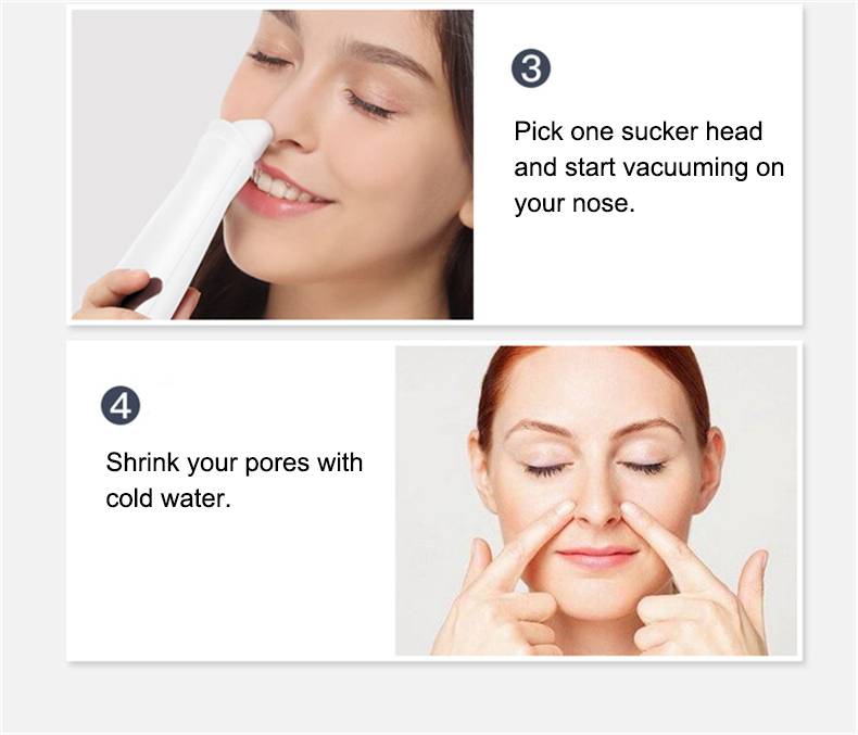 Máy Hút Mụn Đầu Đen Thông Minh Làm Sạch Lỗ Chân Lông Công Nghệ Cao Acne Remover Instrument
